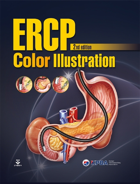 ERCP Color Illustration 2nd edition
