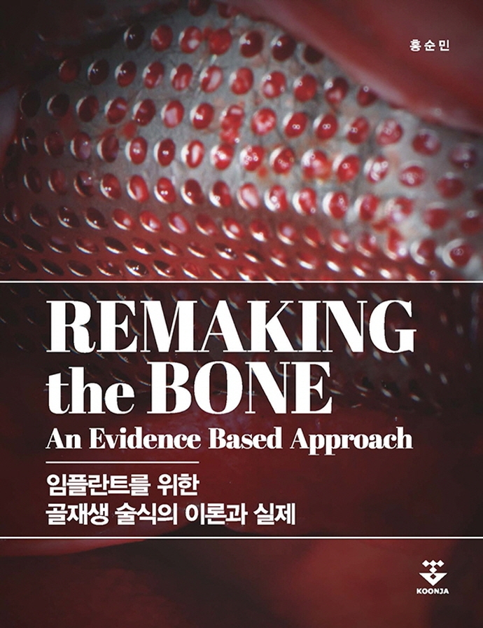 Remaking the bone (임플란트를 위한 골재생 술식의 이론과 실제)